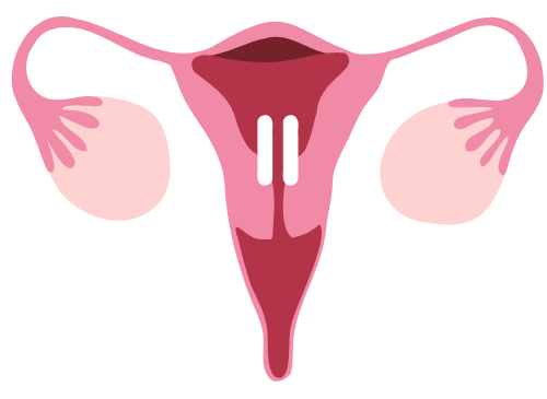 dessin utérus en pause diététicienne